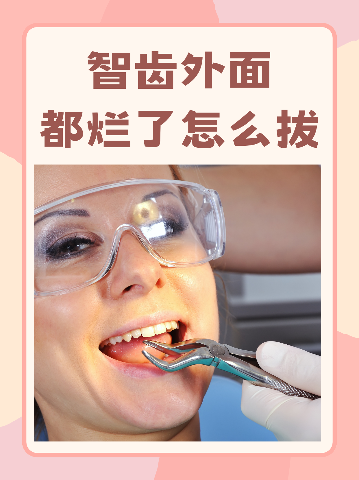 河南拔智齿是什么意思网络用语(河 南 拔 智 齿)-第2张图片